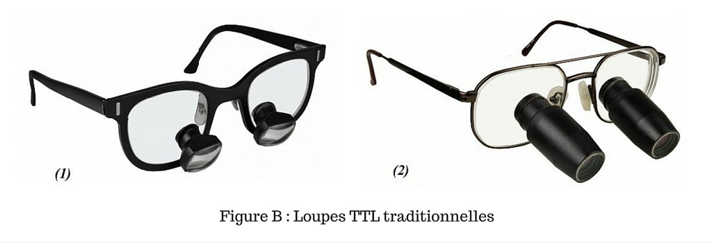 Loupes TTL traditionnelles