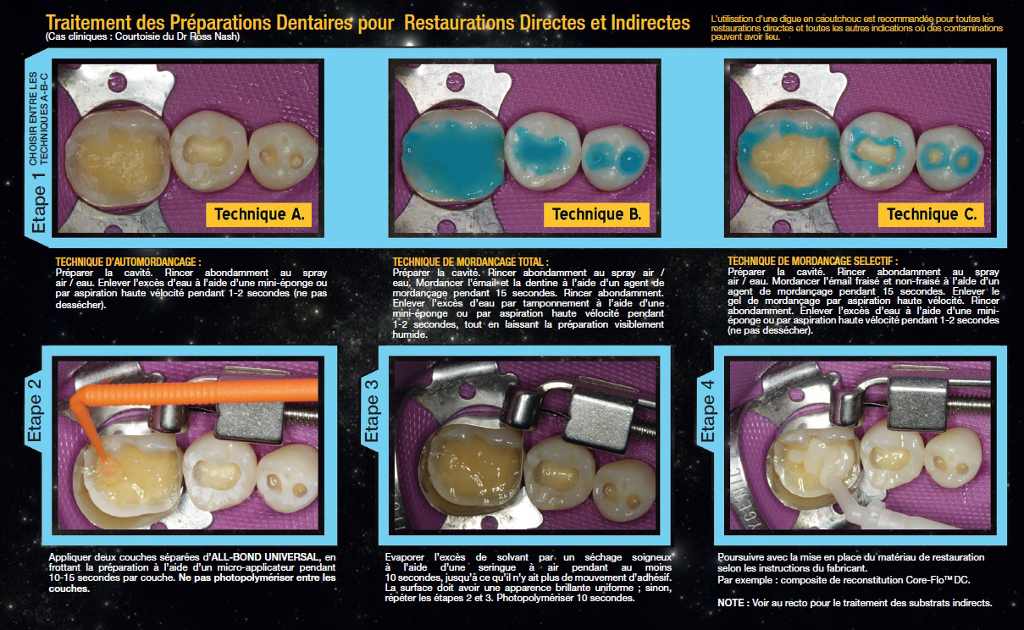 Smile Lite est un éclairage calibré à 5 500°K (lumière du jour) qui réduit de manière drastique le risque d'erreur lors de la prise de teinte