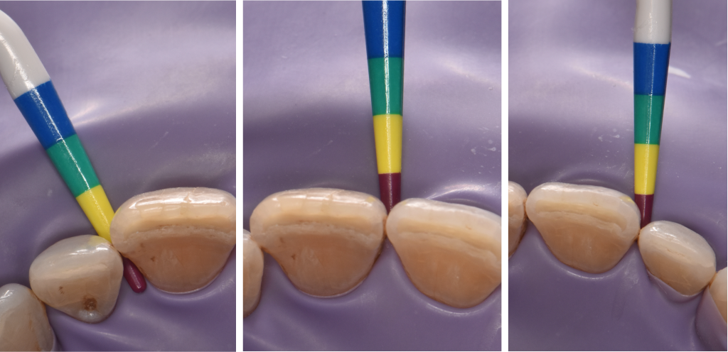 Sélection des matrices BioClear BT à l’aide de la jauge de mesure colorée BT.