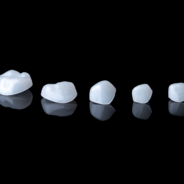 Coiffes pédiatriques biocéramiques Ceramir Pediatric Crown Bisico France – restauration esthétique et conservatrice pour dents temporaires.